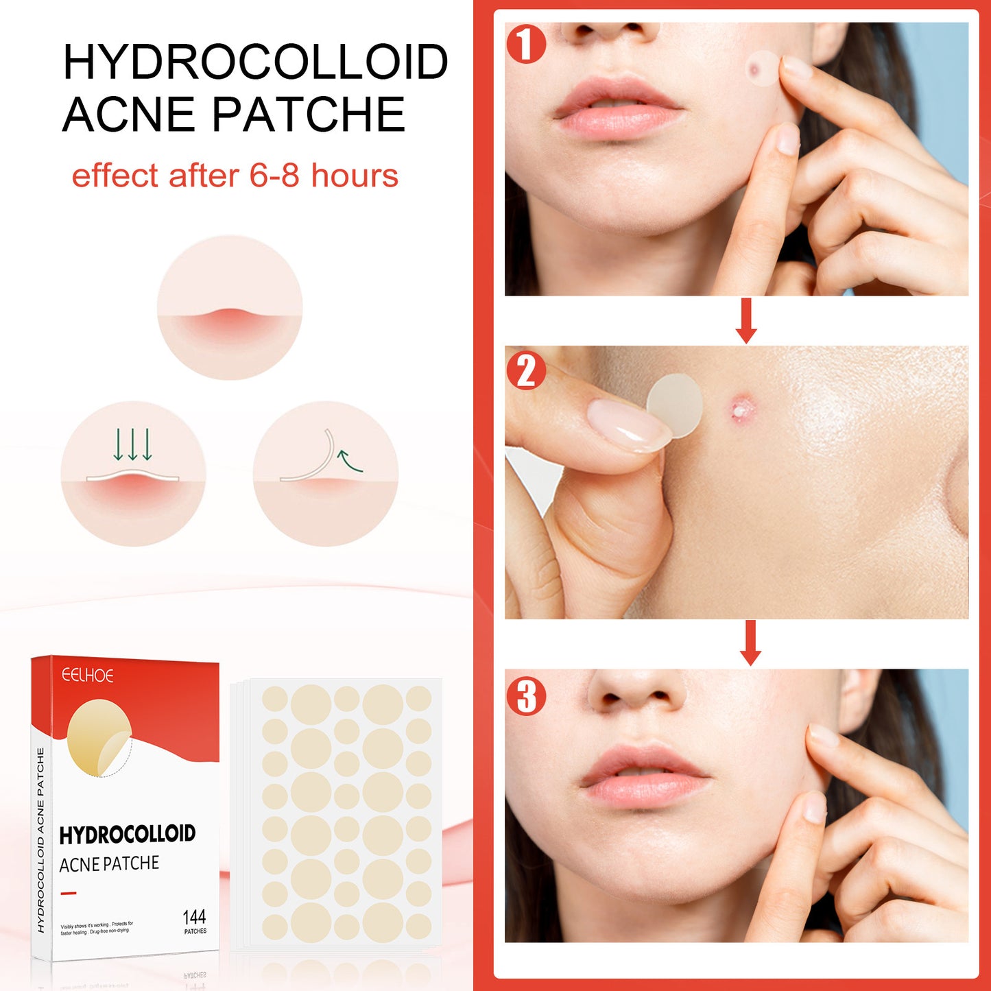 Original Patch - Hydrocolloid Acne Pimple Patch for Covering Zits and Blemishes, Spot Stickers for Face and Skin