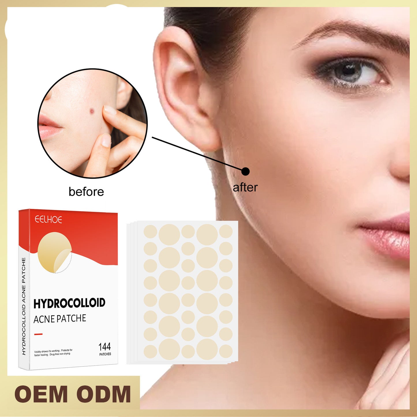 Original Patch - Hydrocolloid Acne Pimple Patch for Covering Zits and Blemishes, Spot Stickers for Face and Skin